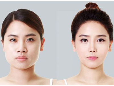 别盲目尝试!5个瘦脸误区要警惕
